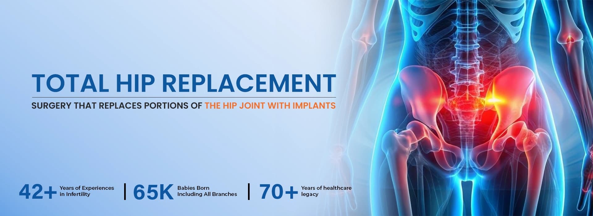 Best hip treatment in Gurgaon