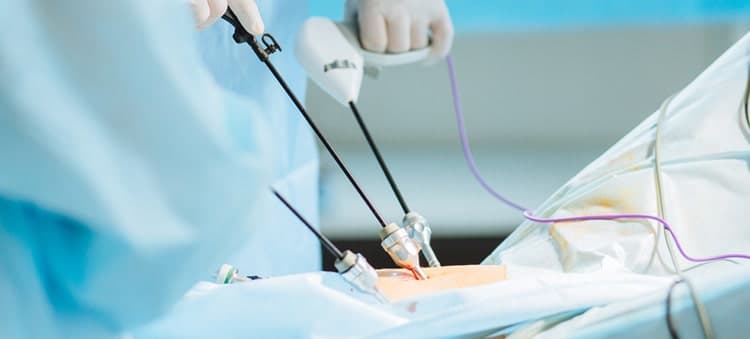 laparoscopic cholecystectomy treatment in gurgaon