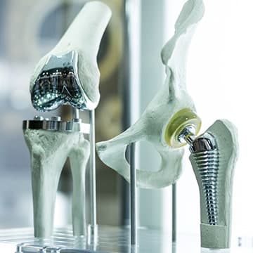 best hospital for hip replacement in gurgaon, hip replacement surgeon in gurgaon