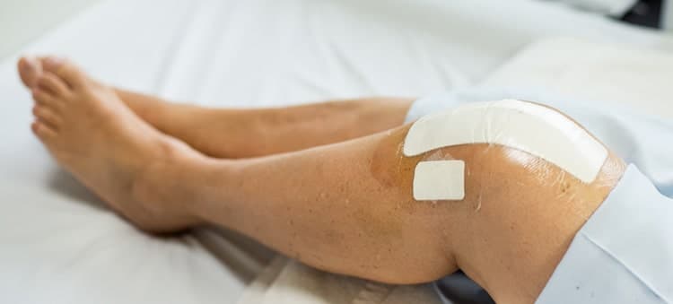 Knee Replacement Surgery In Gurgaon, Knee Replacement Surgery Cost In Gurgaon