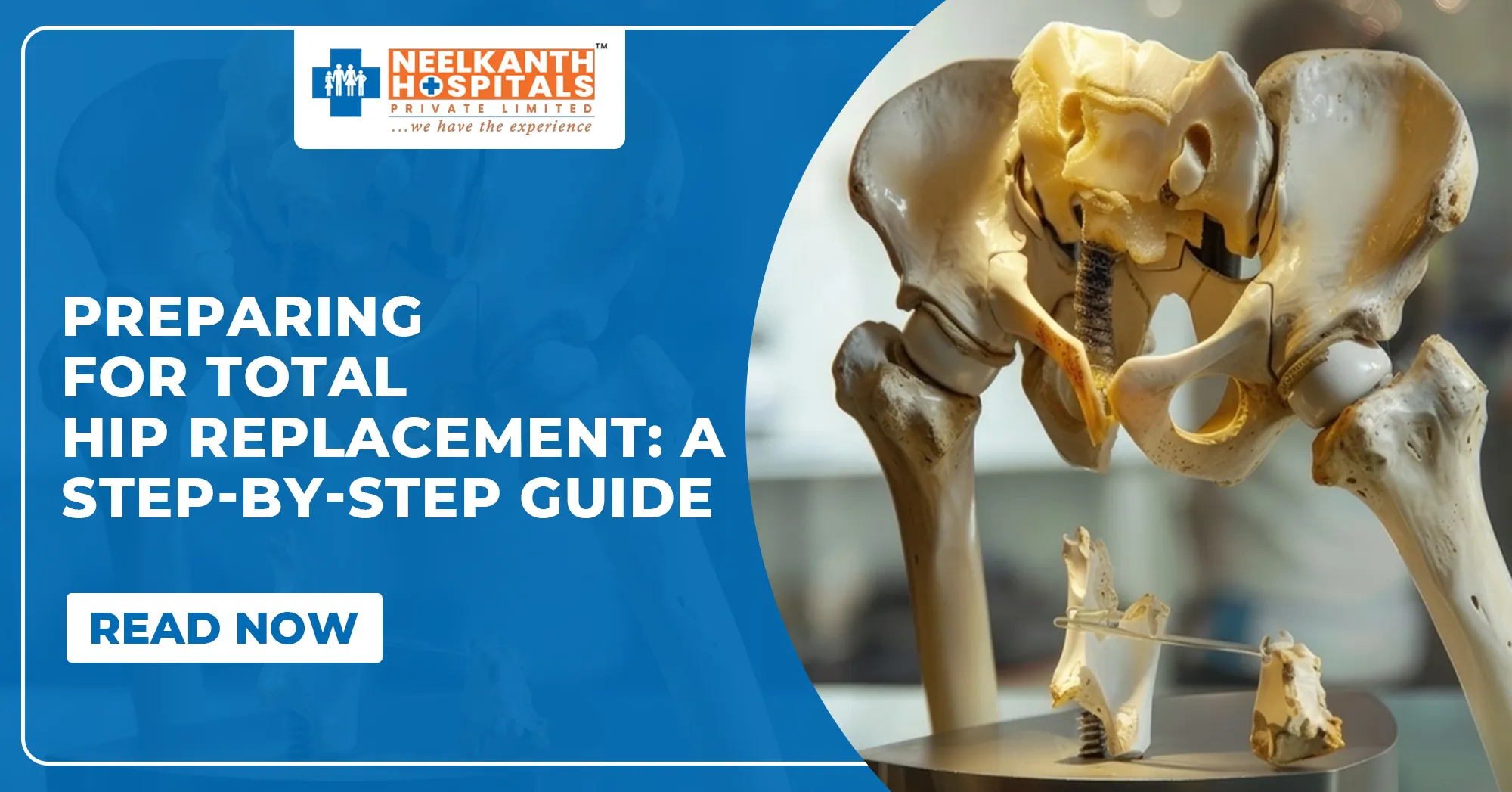 Preparing For Total Hip Replacement: A Step-by-Step Guide