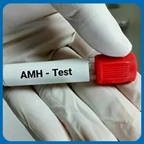 Understand Anti-Mullerian Hormone (AMH) Role and Its Importance